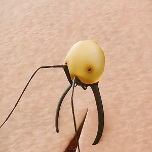 put the 🐜