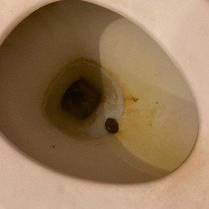 My dad did not let me eat poop