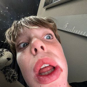 Autistic yoda