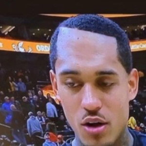 HAIRLINE