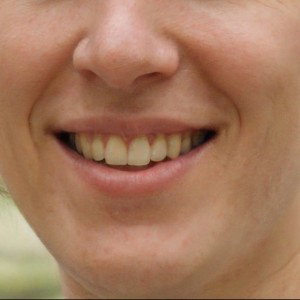 Summer Smile