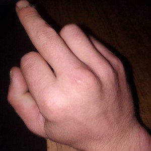 Иди лесом 🖕