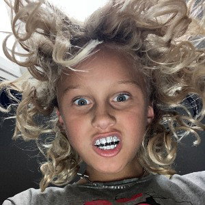 look at my teeth