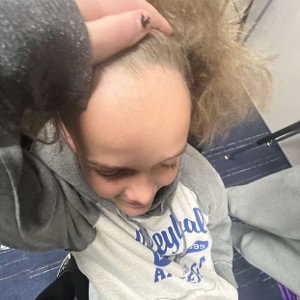 Biggie Forehead