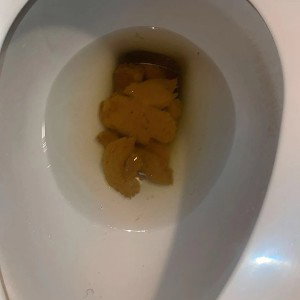 shit