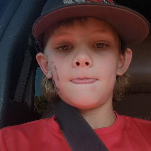 baseball