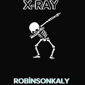 XRAY(BU ARADA MAHLASIM İKİ TANE VAR ROBEN VE ROBİNSONKALY BİLGİLENDİRME OLSUN)