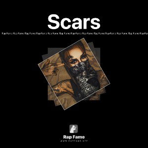 Scars
