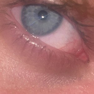 Nevalose
