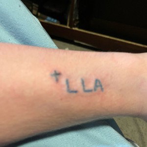 LLA