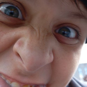 anale