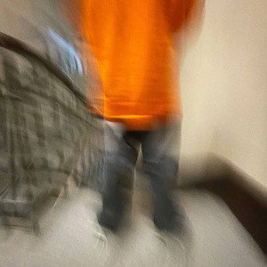 9mice,kai angel-Ринопластика