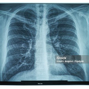 X ray ⚡💥