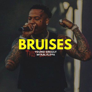 Bruises (11:00:45)