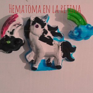 Hematoma en la retina