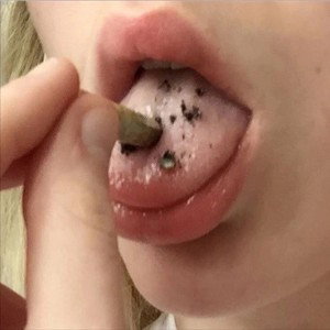 Анти-Пати