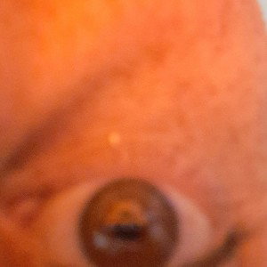 focus