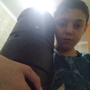 я уже больше не могу это объяснить только одним глазом могу сказать что не хочу быть как ты думаешь это нормально.