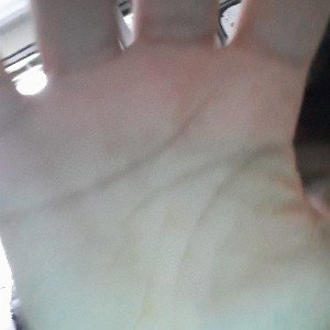 ice