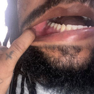 toothache  flow