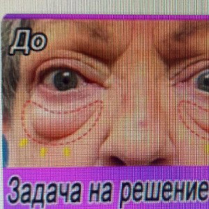 эклерчик стелька 