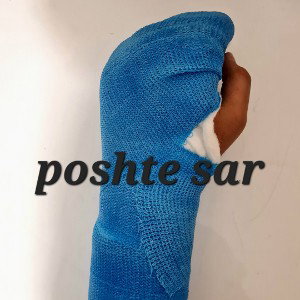 poshte sar