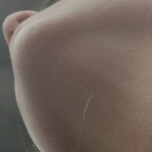72