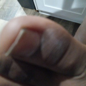 big toe