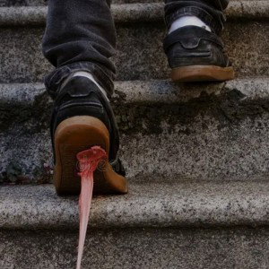 Legs Stuck