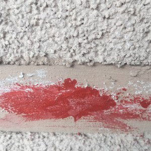 blood in my  pants