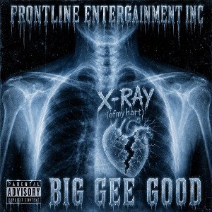 X-RAY (ofmyhart)