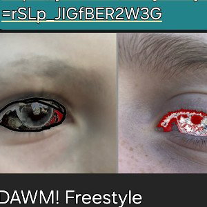 DAWM! FREESTYLE REMIX