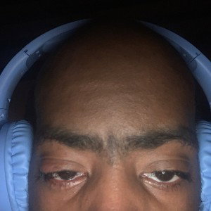kg