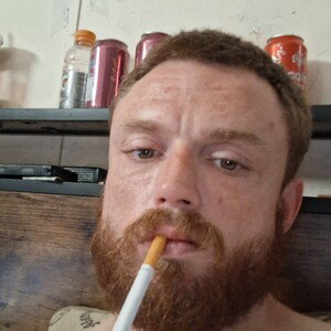 heat stroke