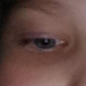 Eye diamond