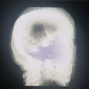  Static hhhdd