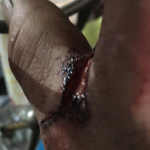 NEVER HEAL