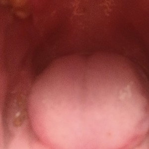 sore throat album track one