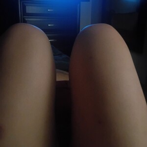 knee DS