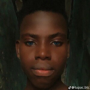 pain in eyes 