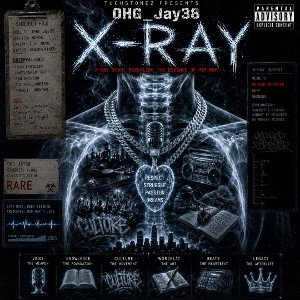 X-Ray