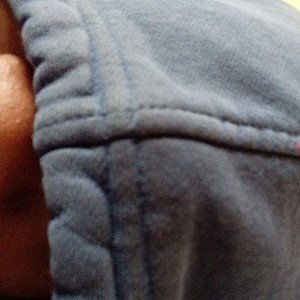 a dog ate my toes