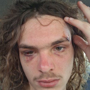 ice