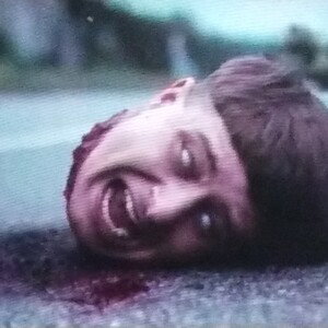 hurt Oliver tree 