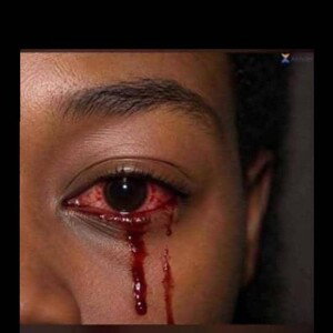 Blood hurt 