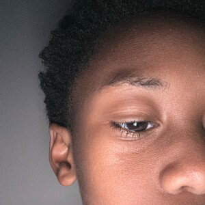 1 eye