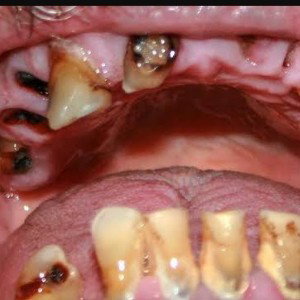 #Rotten Diss 3