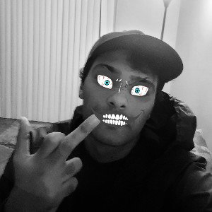 SSBD