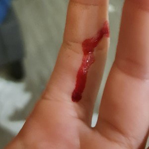 cut your neck