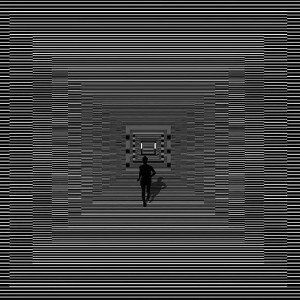cataract